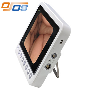 กล้องวิดีโอส่องตรวจภายในแบบ 4 in 1 พร้อมโปรเซสเซอร์ในตัว  แบบพกพา สำหรับตรวจกล่องเสียง โพรงจมูก ขนาด 380 มม. ใช้ได้กับการส่องกล้องข้อ  ระบบทางเดินปัสสาวะ  ระบบทางเดินปัสสาวะในถุงน้ำดี  และการส่องกล้องตรวจภายในมดลูก - Product Image 1