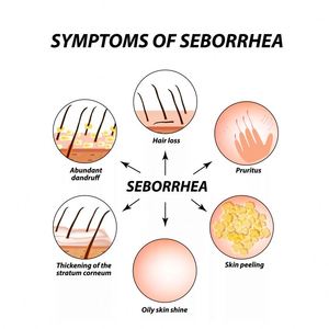 Crème de soin du <span class=keywords><strong>cuir</strong></span> <span class=keywords><strong>chevelu</strong></span> South Moon, crème nettoyante, hydratante et réparatrice pour le <span class=keywords><strong>cuir</strong></span> <span class=keywords><strong>chevelu</strong></span>, soulagement des démangeaisons et de l'eczéma, soin topique - Product Image 6