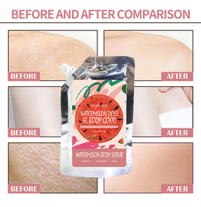 Herbicos Private Label ODM Vitamine C Corps Gommage Crème Cosmétiques Blanchiment Effets Lissants Vente En Gros Soins <span class=keywords><strong>De</strong></span> <span class=keywords><strong>La</strong></span> Peau Produit <span class=keywords><strong>De</strong></span> Beauté - Product Image 6