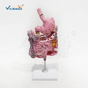 Modelo <span class=keywords><strong>de</strong></span> Simulación <span class=keywords><strong>de</strong></span> Enfermedades del Sistema Digestivo - Modelo Anatómico <span class=keywords><strong>de</strong></span> Ciencias Médicas para Entrenamiento en Escuelas <span class=keywords><strong>de</strong></span> Medicina Vic Science Model - Product Image 5