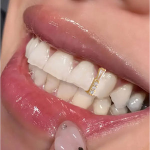 Teeth <b>Gap</b> Braces Gold Silver Geometric Inlay Channel Setting Everyday Wear Unisex - Product Image 2