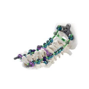 Premium MOMO Titanium Polyaxial <strong>Spinal</strong> Pedicle Screw <strong>Veterinary</strong> Medical Surgical Implant for Intervention - Product Image 5
