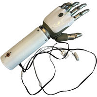 Prótesis de mano motorizada para miembro superior con carcasa de antebrazo y cables de electrodo externos para profesionales de rehabilitación