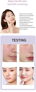 เครื่องดูแลผิวหน้าแบบครบวงจร V10 9 in 1 |   ร้านเสริมสวยและผลิตภัณฑ์ดูแลผิวที่บ้าน ฟื้นฟูผิว ทำความสะอาด ยกกระชับ และดูแลรอบดวงตา - Product Image 5