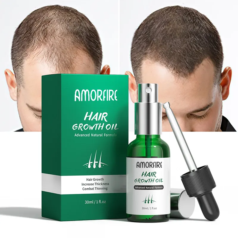 Aceite de jengibre para el crecimiento del cabello, extracto Herbal Natural, profundo, antipérdida, protege el daño, suero para el cuidado del cabello