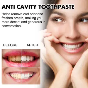 Pasta de dentes para remoção de mau hálito oral de marca própria, pasta de dentes anti-caspa, creme de dentes iluminador