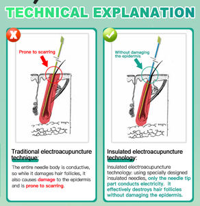 Beauty Skin OEM ODM 2 en 1 Stylo d'élimination des grains de beauté Pince à épiler isolée Électrolyse Machines d'épilation Vente avec aiguille * 6 pièces - Product Image 4