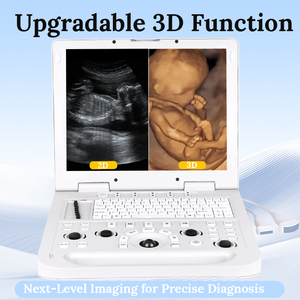 Mesin USG Doppler Warna 2D 3D 4D 5D Berbasis Laptop untuk Klinik Hewan, Peralatan Diagnostik Veteriner - Product Image 4