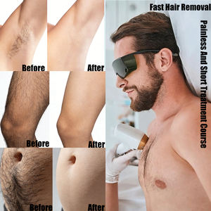 Machine d'<span class=keywords><strong>épilation</strong></span> au laser à diode portable 808 nm avec 755 808 1064 nm, <span class=keywords><strong>épilation</strong></span> rapide et indolore, certifiée CE MDR - Product Image 6