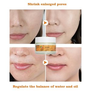 Tăng Ánh Nghệ Thảo Dược Mặt Kem Làm Trắng Và Loại Bỏ Mụn Trứng Cá Mụn Mặt Chống Mụn Kem Cho Da Đen - Product Image 5