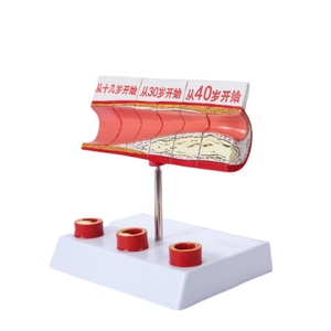 Model perubahan ologis vaskular untuk semua tahap usianya-akurat secara anatomis untuk demonstrasi pendidikan medis & penyakit - Product Image 2