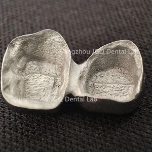 Prothèses dentaires et ponts métalliques de haute qualité <span class=keywords><strong>en</strong></span> forme de lustre métallique, laboratoire dentaire de Chine à bas <span class=keywords><strong>prix</strong></span> et de bonne qualité - Product Image 4