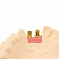 Couronne dentaire en zircone de marque Ecolab Premium pour laboratoire clinique dentaire, haute résistance, restauration dentaire, compatible CAD CAM, contour complet