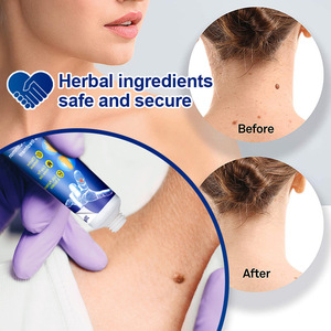 Body <strong>Warts</strong> Treatment <strong>Cream</strong> Skin Tag Remover Foot Corn Removal Extrat Plantar <strong>Genital</strong> <strong>Warts</strong> Ointment <strong>Cream</strong> - Product Image 3