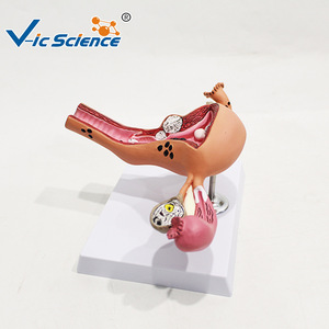 Modelo patológico uterino femenino humano; modelo de demostración para enseñanza y formación médica ginecológica; material didáctico de anatomía. - Product Image 3