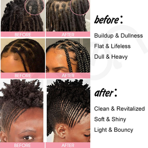 Après-shampoing purifiant détoxifiant au <span class=keywords><strong>vinaigre</strong></span> de <span class=keywords><strong>cidre</strong></span> de pomme pour le cuir chevelu, marque privée, pour le nettoyage des tresses, soulagement des démangeaisons, nettoyage en profondeur, protection et rafraîchissement. - Product Image 5