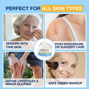 Face Body Hydrating Moisturizer Fast-Acting Arnica Montana Arnica <strong>Bruise</strong> <strong>Cream</strong> <strong>for</strong> Bruising Swelling Discoloration &amp; Thin Skin - Product Image 4