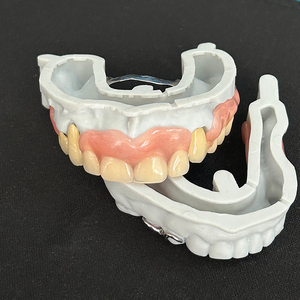 Cadre en alliage Cocr pour prothèses partielles avec base en résine dents acryliques prothèses amovibles en laboratoire dentaire en chine - Product Image 2