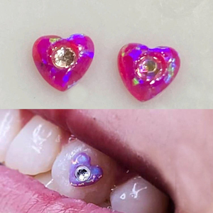 92 Colori di Gioielli Dentali in Opale, Decorazioni per Denti Senza Piombo, Gemme in Opale <span class=keywords><strong>Rosa</strong></span> a Forma di <span class=keywords><strong>Stella</strong></span> da 4mm - Product Image 5