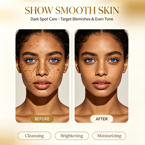Crème Hydratante Éclaircissante Anti-Taches et Anti-Imperfections pour le Visage – Soin Complet Anti-Acné et Anti-Imperfections pour une Peau Unifiée et Lumineuse - Product Image 4