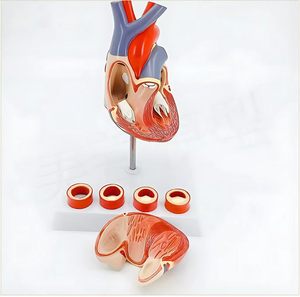 Modelo <span class=keywords><strong>de</strong></span> Corazón con Trombosis - Product Image 5