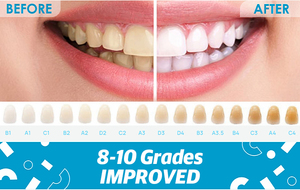 Kit pemutih gigi Salon Klinik Gigi profesional 35% HP kustom Logo pribadi - Product Image 2