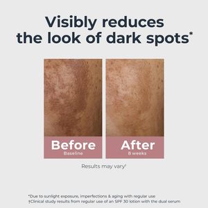 Suero Dual SEYE Radiant Tone 1 Fl Oz Corrector de Manchas Oscuras con Tiamidol y Ácido Hialurónico <span class=keywords><strong>que</strong></span> Ayuda a Reducir Visiblemente las Manchas Oscuras Persistentes - Product Image 4