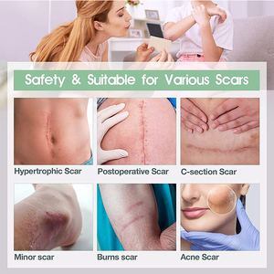 Ruban adhésif en gel <span class=keywords><strong>de</strong></span> <span class=keywords><strong>silicone</strong></span> professionnel à prix avantageux pour les cicatrices - Product Image 6