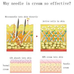 1000G Acne-Porne Gezichtscrème Bleekcrème Voor Donkere Huidvlekkenverwijderaar Private Label - Product Image 4