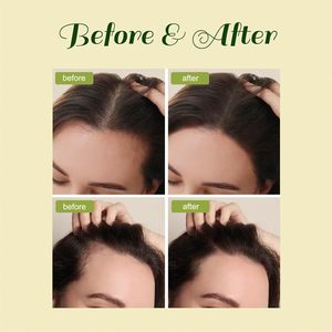 Olio per la crescita dei capelli olio per la crescita dei capelli olio di ricino di rosmarino biologico olio di ricino Batana siero per la crescita dei capelli per gli uomini e le donne - Product Image 3