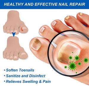Nagel pilzen tfernungs öl Paronychie Anti-Infektions füße Zehen pilz pflege Rempval Paronychie öl zur Reparatur beschädigter Nägel - Product Image 4