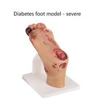 Modelo de pie diabético (leve/grave) para entrenamiento médico y educación