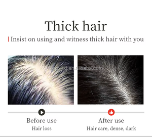 Champú para el Crecimiento del Cabello con Jengibre, Tratamiento Anticaída del Cuero Cabelludo, <span class=keywords><strong>Precio</strong></span> de Fábrica, OEM, ODM, Venta al por Mayor, Cuidado del Cabello - Product Image 4