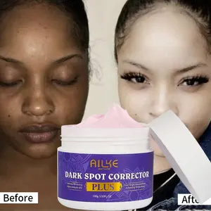 Personalizado Pérola Brilhante Calmante Alvejante Clareamento Sardas Remoção Blemish Face Cream Para A Pele Africana