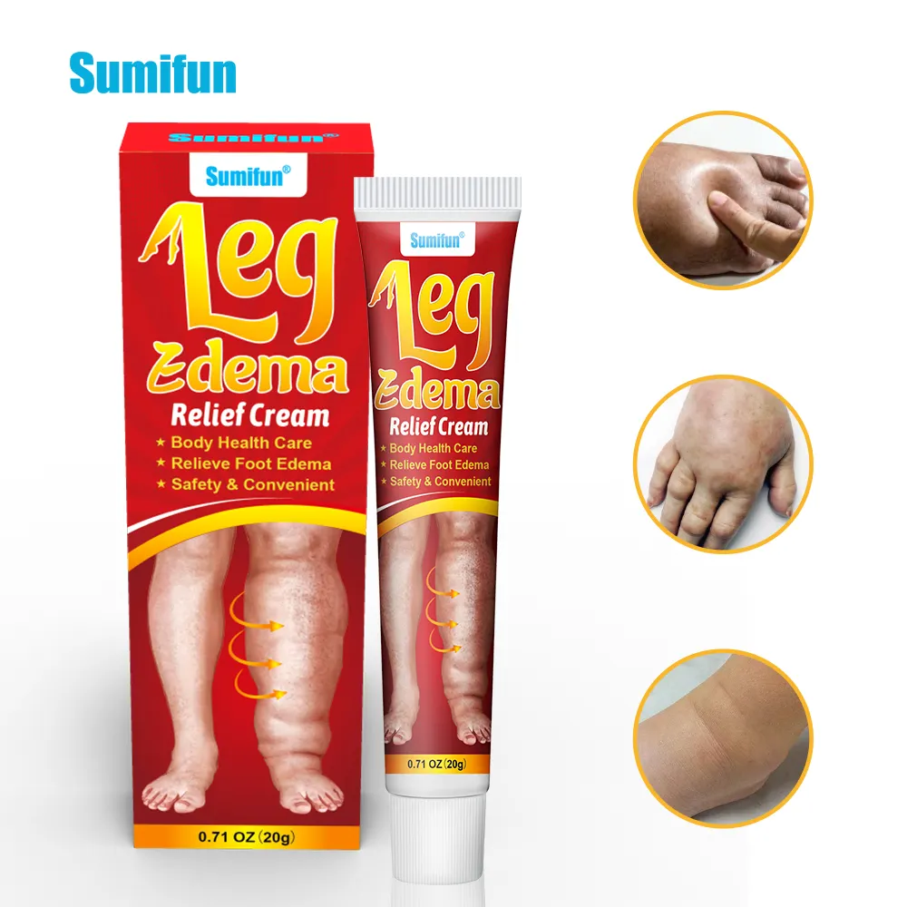 Sumifun krim pereda nyeri Herbal alami 20g, salep perawatan kesehatan tubuh untuk menghilangkan Edema