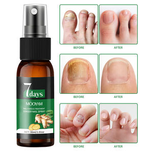 Marque privée Nouveauté 2025 Spray <span class=keywords><strong>antifongique</strong></span> pour ongles 7 jours Répare les dommages aux ongles et aux cuticules Produits <span class=keywords><strong>de</strong></span> soin <span class=keywords><strong>de</strong></span> la peau 30ml MOOYAM Spray pour ongles - Product Image 2