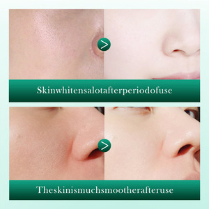 Sérum <span class=keywords><strong>anti</strong></span>-rides apaisant à la centella asiatica et au rétinol de haute qualité, soin de la peau du visage - Product Image 2