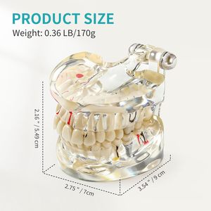 Modelo Dental Patológico Transparente con Dientes de Resina Removibles y Ángulo Ajustable para Enseñanza y Entrenamiento sobre Enfermedades - Product Image 2