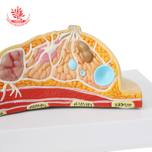 Modelo de patología mamaria humana, modelo de anatomía patológica, enfermedades mamarias comunes, modelo de patología mamaria humana - Product Image 1