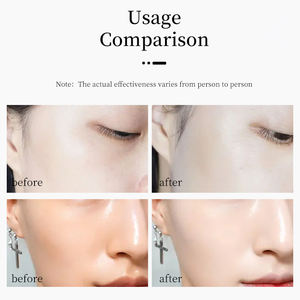 OEM/ ODM Sérum de soin de la peau bio personnalisé Sérum à base de cellules de fruit de pomme Sérum hydratant nourrissant et raffermissant pour femmes - Product Image 5