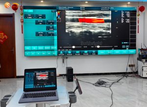 Nieuwste Dubbele Koppen Wifi Echografie Kleur <span class=keywords><strong>Doppler</strong></span> 128 Elementen Kleur Draadloze Convexe Lineaire Sonde - Product Image 3