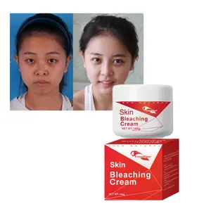 Hoge Kwaliteit Whitening Sproet Melasma Verwijderen Crème Beste Hand En Voet Whitening Cream Voor Afrikaanse Huid