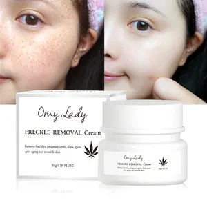 Korean face cream omy lady freckle removal permanent whitening anti freckle facial cream