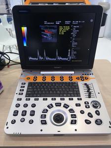 Ecógrafo Doppler Color Portátil de Grado Profesional Dawei DW-P60 con Imágenes de Elastografía para Diagnóstico Veterinario - Product Image 4