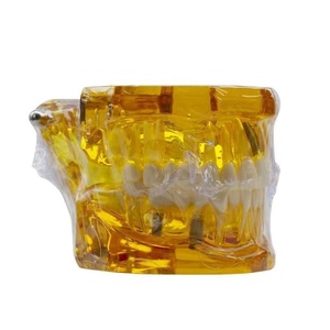 Modello di Denti Permanenti in Resina Trasparente Ambrata, Modello Dentale Articolato Standard per l'Insegnamento Orale - Product Image 2