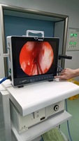 Système de caméra endoscopique médicale portable IKEDA YKD-9115 avec écran LCD HD 1080P pour ORL, usage hospitalier, oreille, nez, gorge, garantie 2 ans