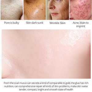 2% <span class=keywords><strong>Alfa</strong></span> <span class=keywords><strong>Arbutina</strong></span> Aligeramiento Melanina Esencia Facial Esencia Blanqueadora Líquido - Product Image 5