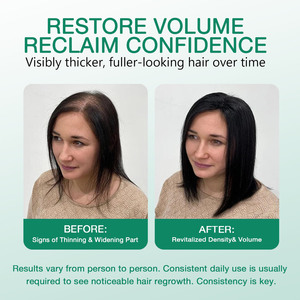 <span class=keywords><strong>เซ</strong></span><span class=keywords><strong>รั่</strong></span><span class=keywords><strong>ม</strong></span>บำรุงเส้นผ<span class=keywords><strong>ม</strong></span>และหนังศีรษะ <span class=keywords><strong>J</strong></span> Private Label Strengthen & Boost <span class=keywords><strong>Hair</strong></span> Density Serum Polypeptide ช่วยเพิ่<span class=keywords><strong>ม</strong></span>ความหนาแน่นของเส้นผมและหนังศีรษะด้วยเปปไทด์  แบบโรลออน - Product Image 6