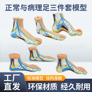 Modèle de pied normal, modèle de pied plat, modèle de genou arqué, modèle de pathologie du pied, modèle d'anatomie musculaire du pied humain - Product Image 3