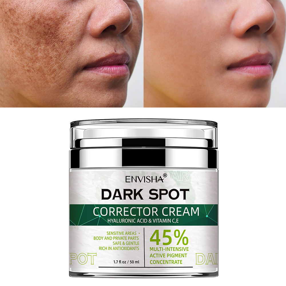 Private Label Face Black Freckle Acne Fade Dark Spot Removing Corrector Whitening Cream